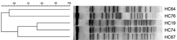 Ηλεκτροφόρηση παλμικού πεδίου Pulsed field gel electrophoresis Διαχωρισμός μεγάλων μορίων DNA από περίπου 20kb μέχρι και 5Μb!