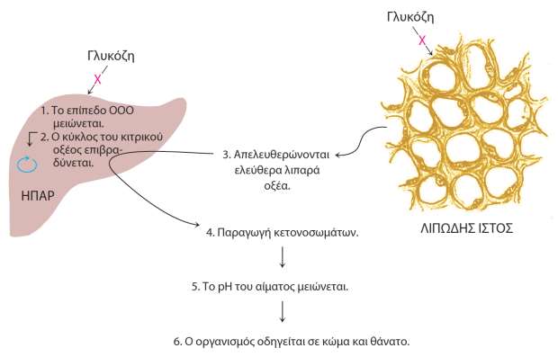 Διαβητική κετοξέωση Επικίνδυνη για την ζωή κατάσταση σε ασθενείς με