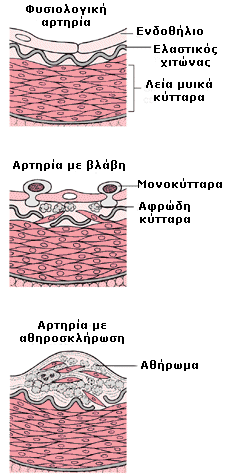 πάνω από το φυσιολογικό μπορούν να αυξήσουν υπερβολικά τον κίνδυνο για ΑΕΕ.
