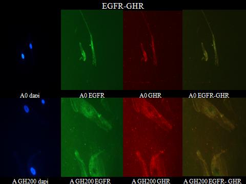 4β. Διπλός ανοσοφθορισμός EGFR/GHR Ελέγχθηκε η κοινή ενδοκυττάρια εντόπιση των υποδοχέων EGFR και GHR. Η μεμβρανική εντόπιση των υποδοχέων είναι αυτή που τους καθιστά λειτουργικούς.