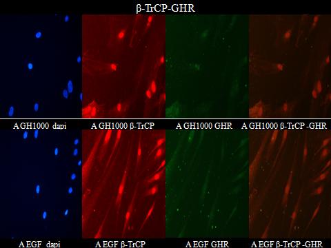 β-trcp-ghr Μ EGF dapi Μ EGF β-trcp Μ EGF GHR Μ EGF β-trcp -GHR Εικόνα: Μάρτυρας (0, GH200, GH1000, EGF): dapi β-trcp - GHR συγχώνευση Οι πρωτεΐνες συνυπάρχουν στο κυτταρόπλασμα, ιδιαίτερα