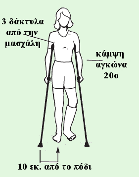 Από ποια μέρη αποτελείται η βακτηρία αντιβραχίου; Η βακτηρία αντιβραχίου αποτελείται από το στήριγμα του αγκώνα, τη χειρολαβή και το λαστιχένιο άκρο.