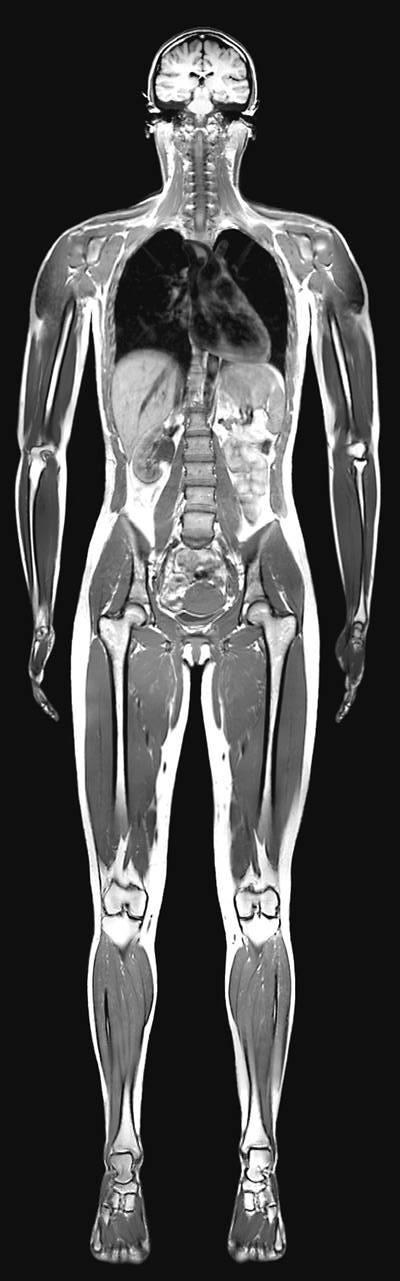 RIS-Radiology Information System Πληροφοριακό Σύστημα Ακτινολογίας Πρόκειται για μια ηλεκτρονική βάση δεδομένων που χρησιμοποιείται από τις υπηρεσίες της ακτινολογίας για την αποθήκευση, διαχείριση
