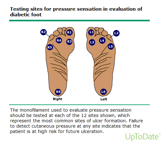 ADA = 4 testing sites U.S.