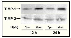 πνςηεσκχκ ηαζ ακμζμζηφπςια ιε εζδζηά ακηζζχιαηα έκακηζ ημο TIMP-1 ή ημο TIMP- 2, ημ θζθι ρδθζμπμζήεδηε