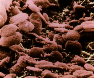 ερυθροκυττάρων Ύψος στήλης αίµατος 100