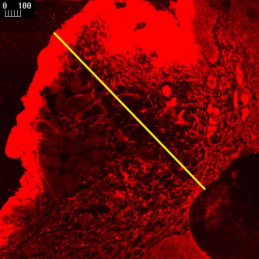Διδακτορική Διατριβή Μαρίασ Κυριαζή Οι εικόνεσ προκφπτουν από τομζσ 0, 20, 40, 60 μm από τθν επιφάνεια του δζρματοσ.