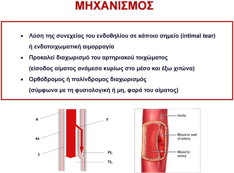 τοιχώµατος (είσοδος αίµατος ανάµεσα κυρίως στο µέσο και έξω χιτώνα)