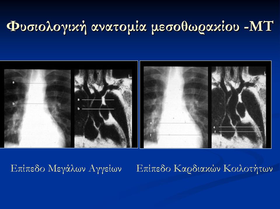 Επίπεδο Μεγάλων