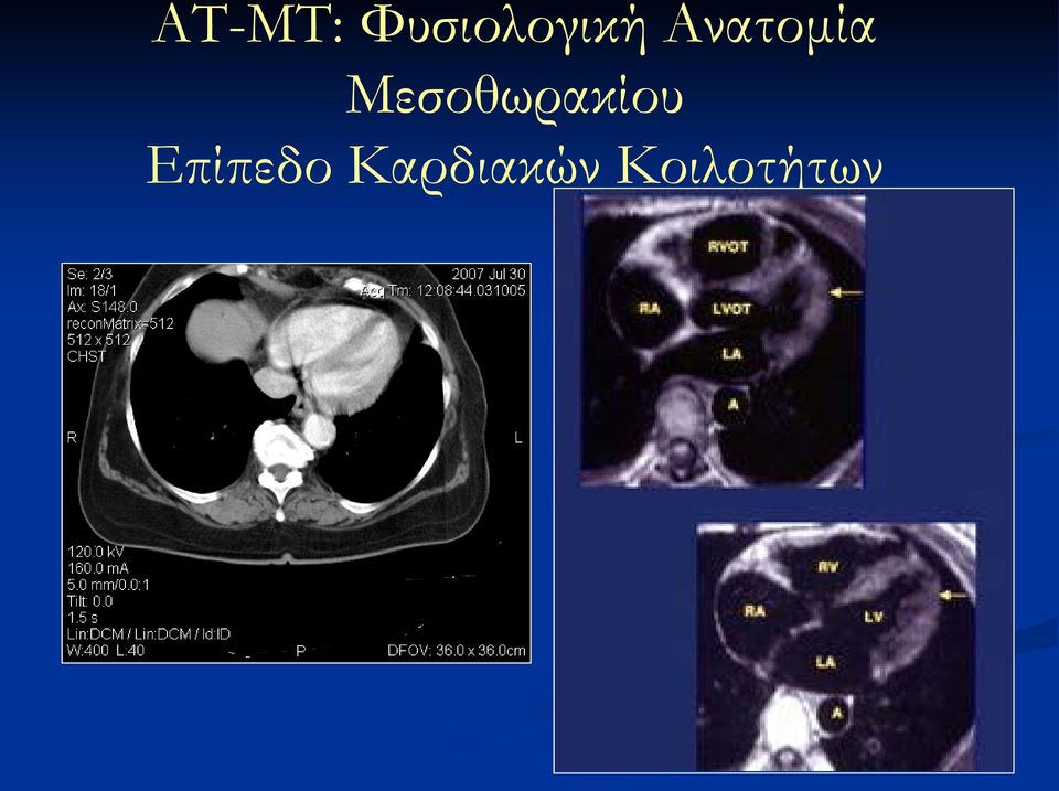 Ανατομία