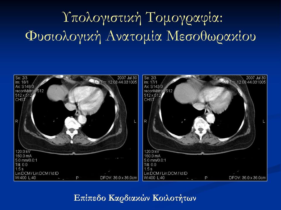 Φυσιολογική Ανατομία