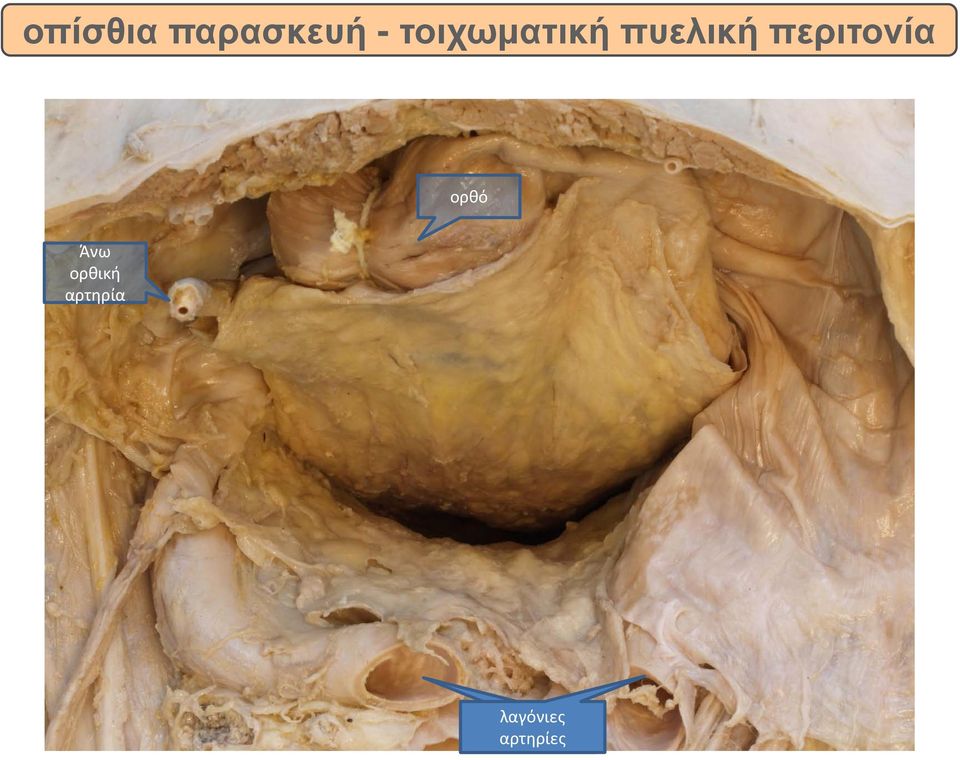 περιτονία ορθό Άνω