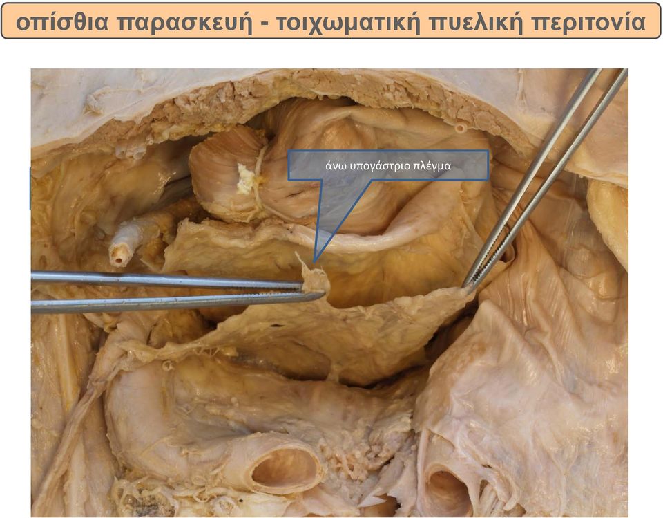 περιτονία rectum