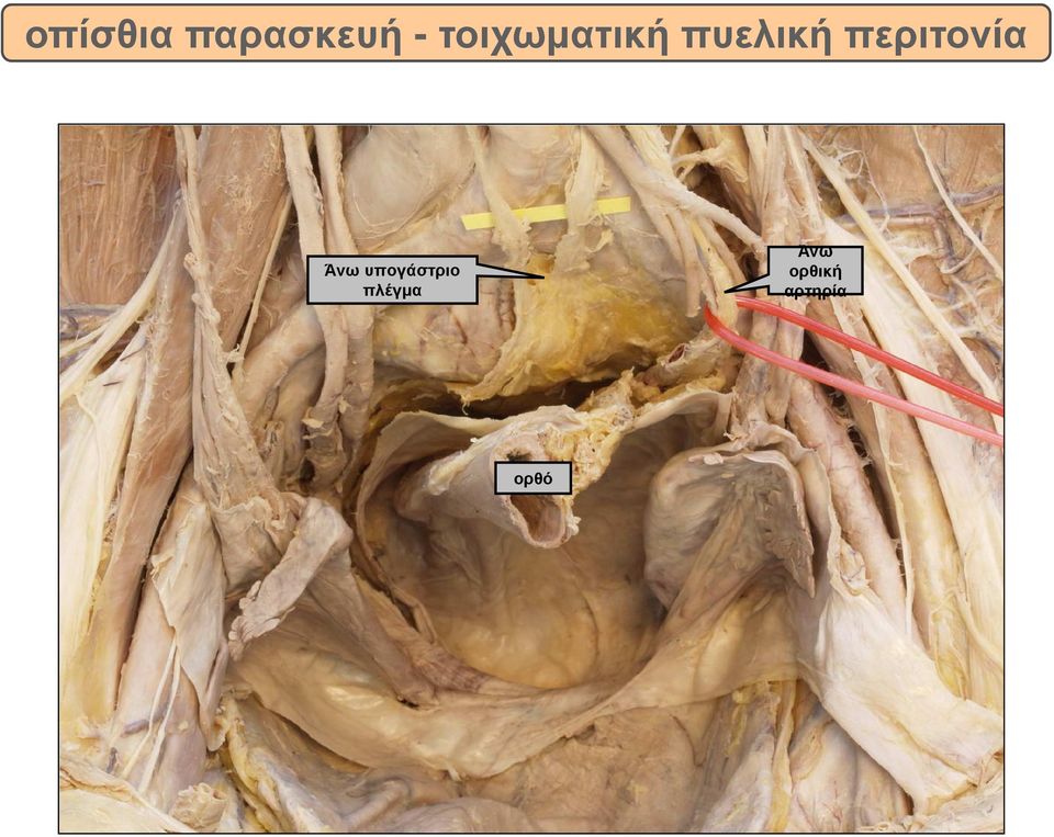 περιτονία Άνω