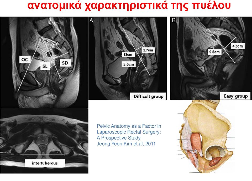 Laparoscopic Rectal Surgery: A