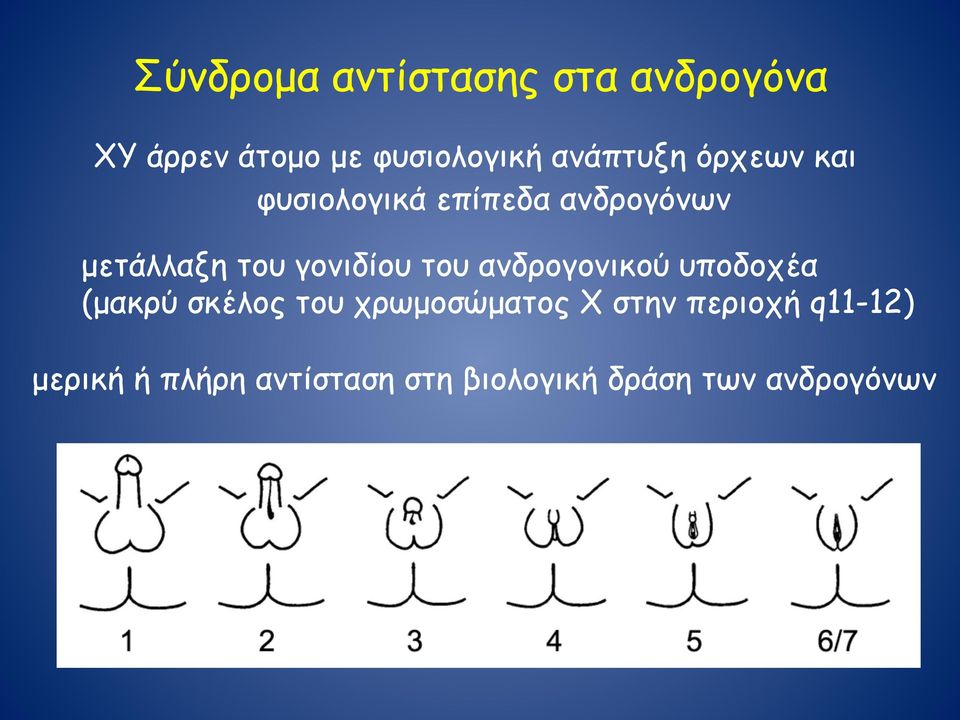 γονιδίου του ανδρογονικού υποδοχέα (µακρύ σκέλος του χρωµοσώµατος Χ