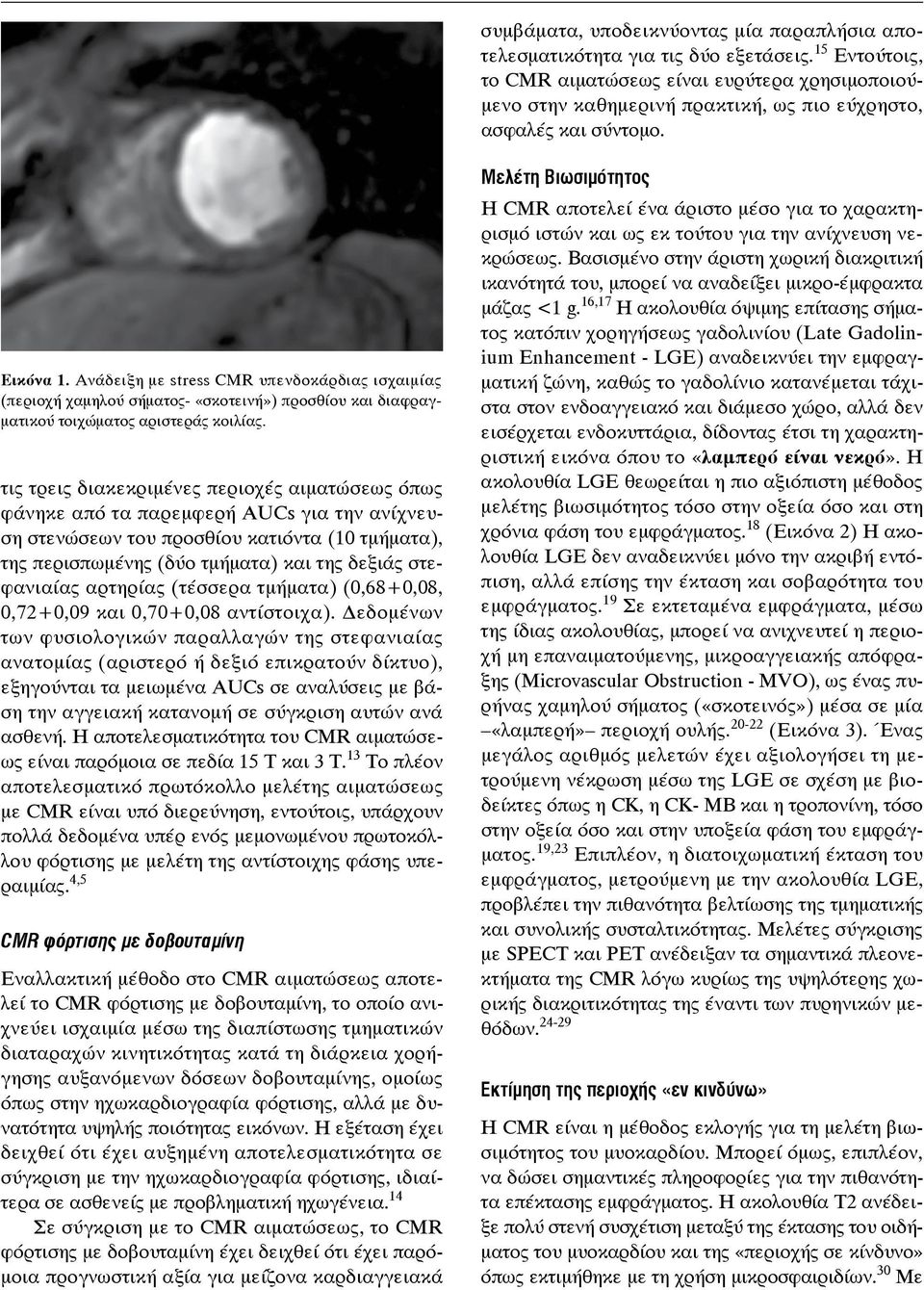 Ανάδειξη με stress CMR υπενδοκάρδιας ισχαιμίας (περιοχή χαμηλού σήματος- «σκοτεινή») προσθίου και διαφραγματικού τοιχώματος αριστεράς κοιλίας.