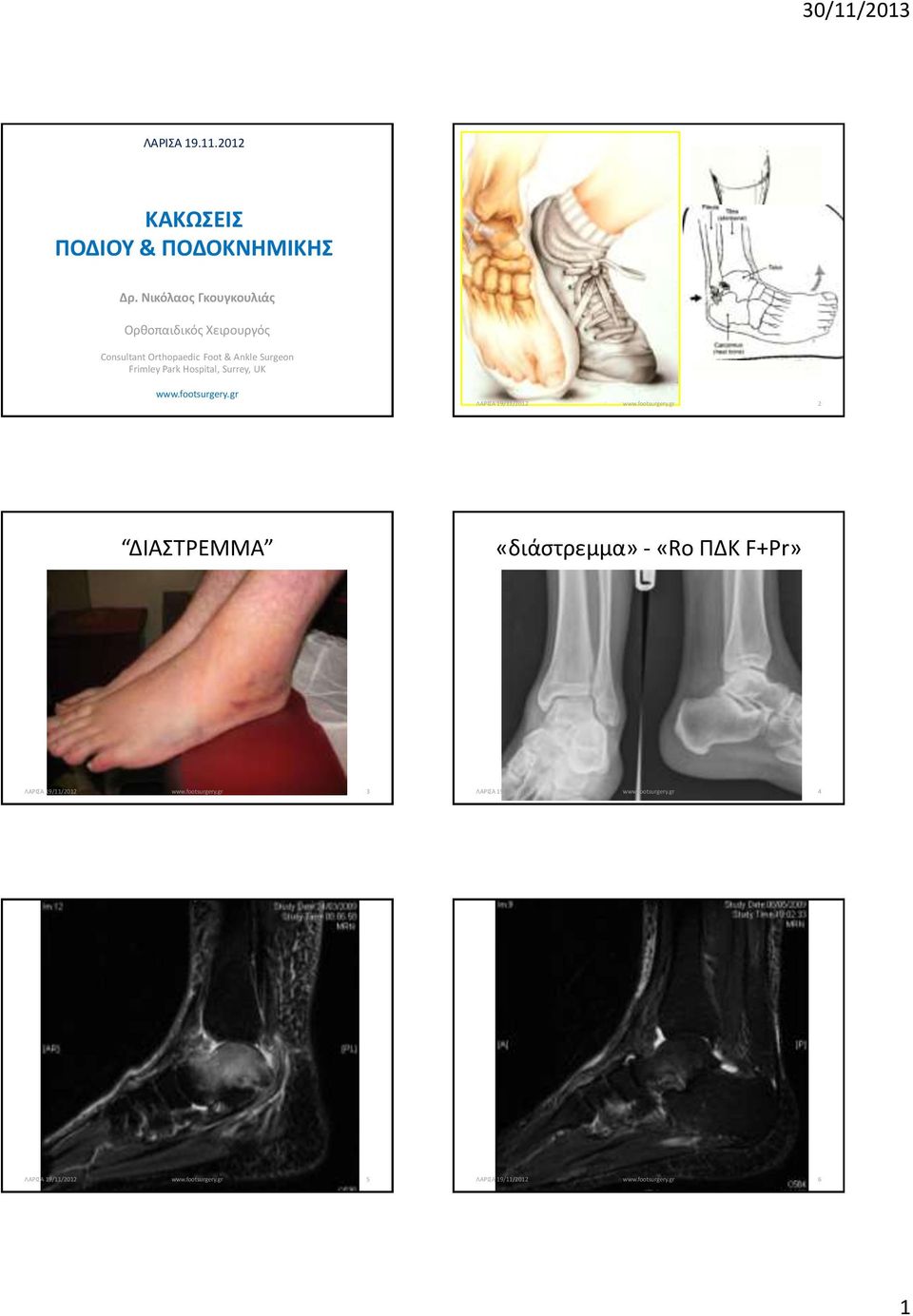 Orthopaedic Foot & Ankle Surgeon Frimley Park Hospital,