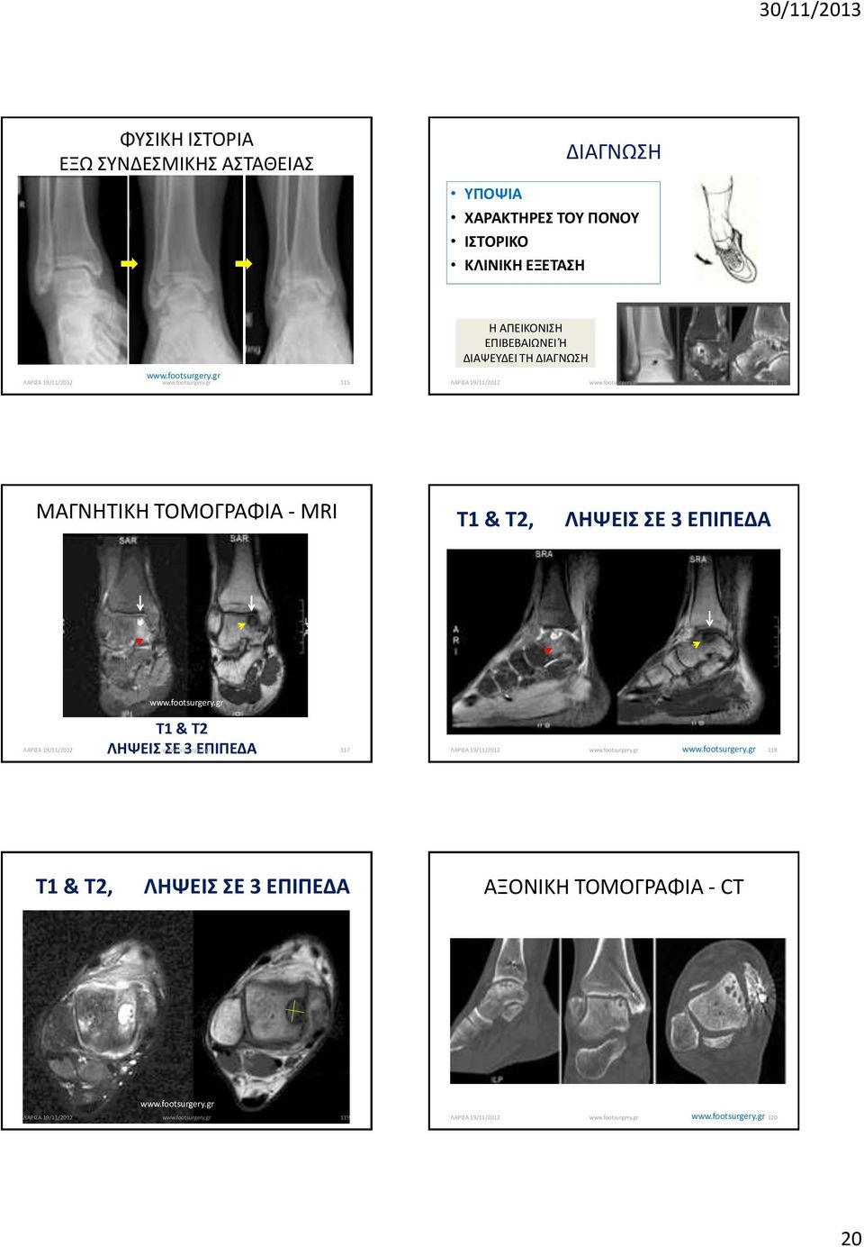 ΜΑΓΝΗΤΙΚΗ ΤΟΜΟΓΡΑΦΙΑ - MRI T1 & T2, ΛΗΨΕΙΣ ΣΕ 3 ΕΠΙΠΕΔΑ T1 & T2 ΛΗΨΕΙΣ ΣΕ 3 ΕΠΙΠΕΔΑ