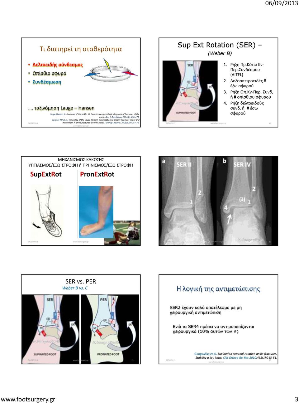 The ability of the Lauge-Hansen classification to predict ligament injury and 06/09/2013 mechanism in ankle fractures: an MRI study. J Orthop Trauma. 2006;20(4):267-72.