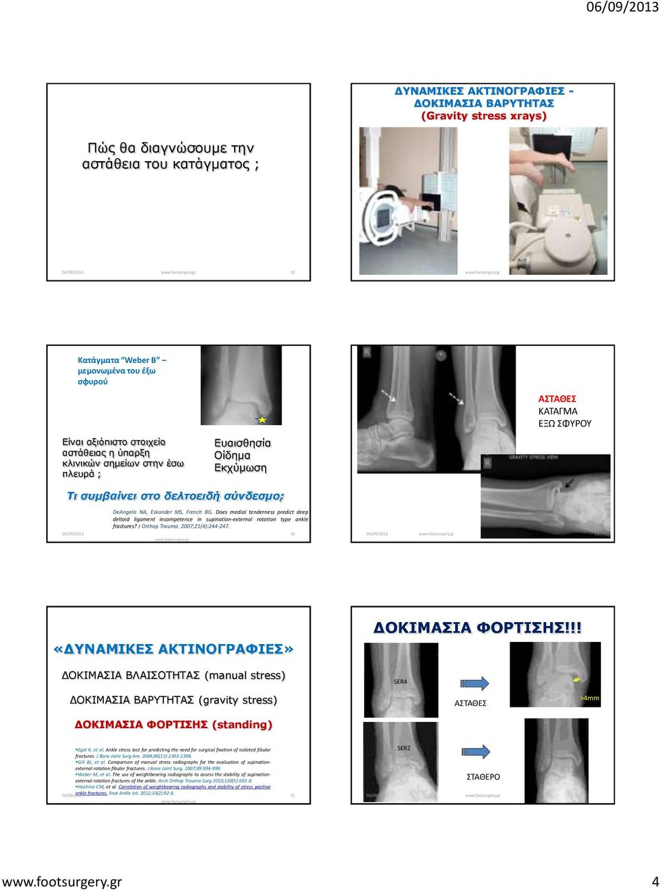 Does medial tenderness predict deep deltoid ligament incompetence in supination-external rotation type ankle fractures? J Orthop Trauma. 2007;21(4):244-247.