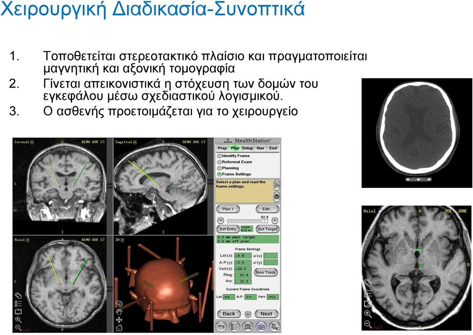 και αξονική τομογραφία 2.