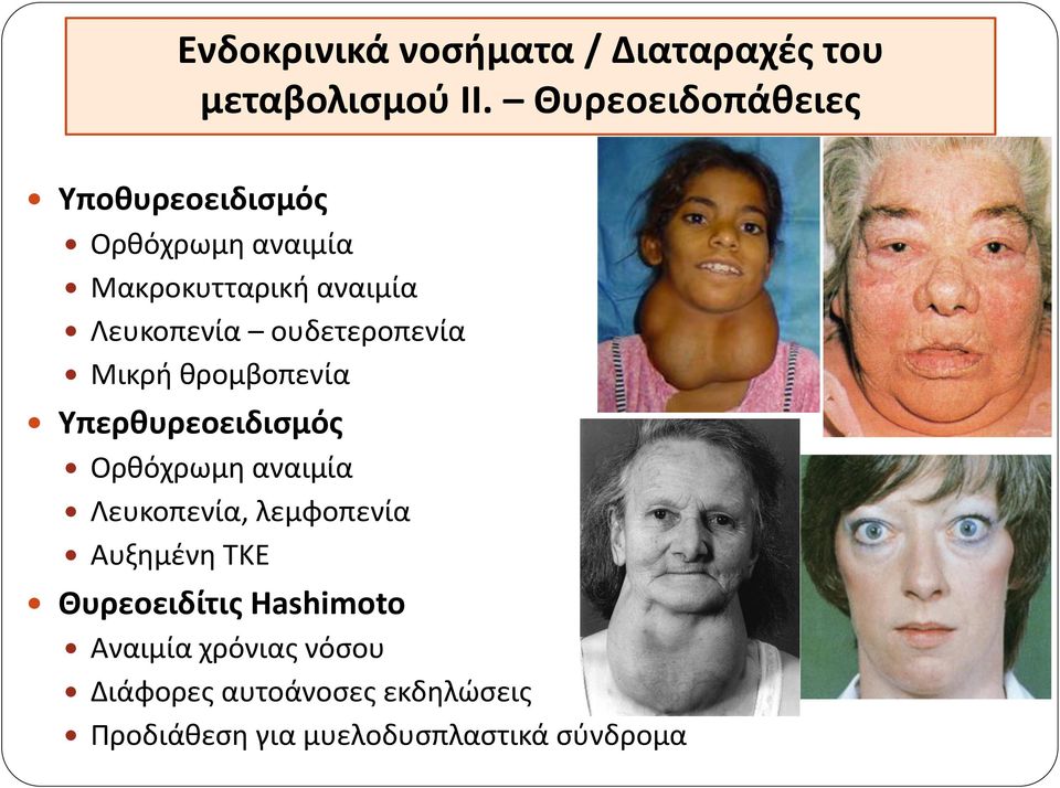 ουδετεροπενία Μικρή θρομβοπενία Υπερθυρεοειδισμός Ορθόχρωμη αναιμία Λευκοπενία, λεμφοπενία