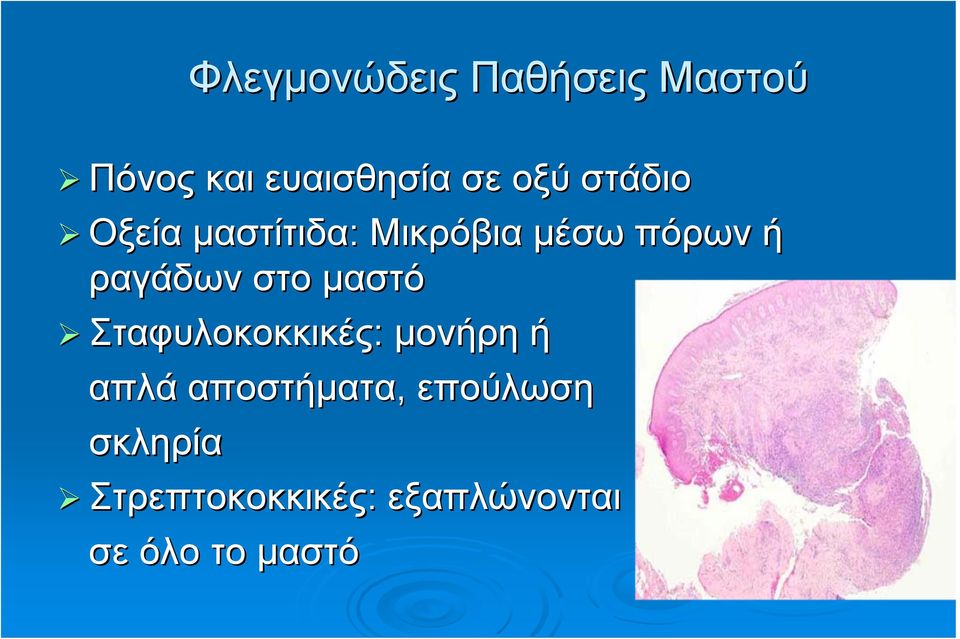 στο μαστό Σταφυλοκοκκικές: μονήρη ή απλά αποστήματα,