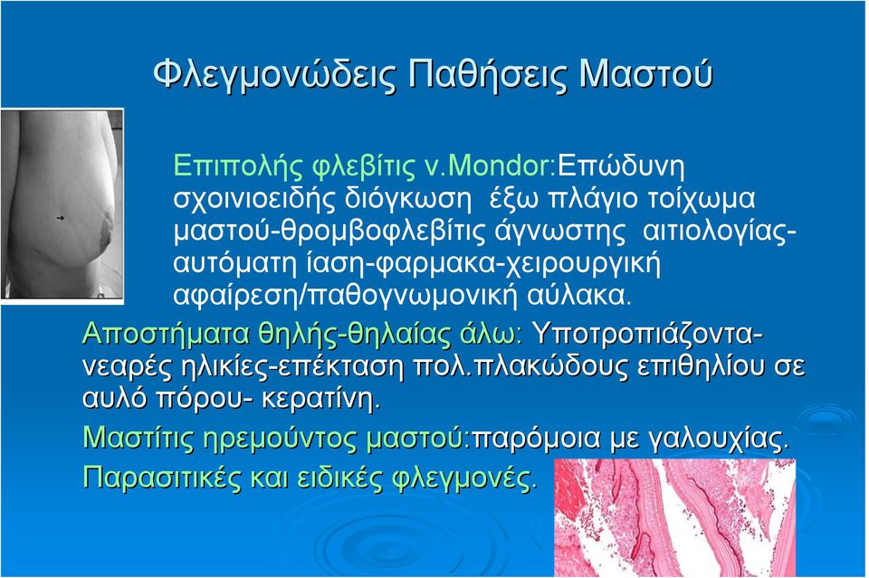 ίαση-φαρμακα-χειρουργική αφαίρεση/παθογνωμονική αύλακα.