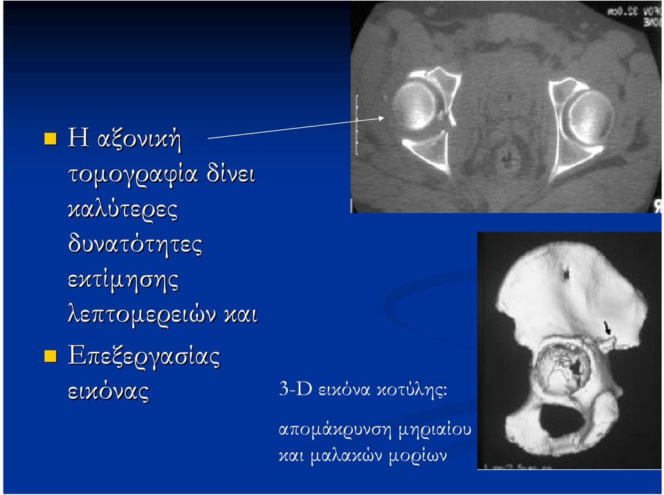 Επεξεργασίας εικόνας 3-D εικόνα