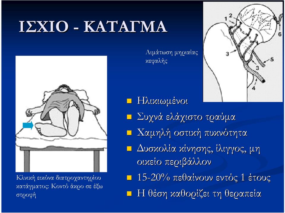 Συχνά ελάχιστο τραύμα Χαμηλή οστική πυκνότητα Δυσκολία κίνησης,