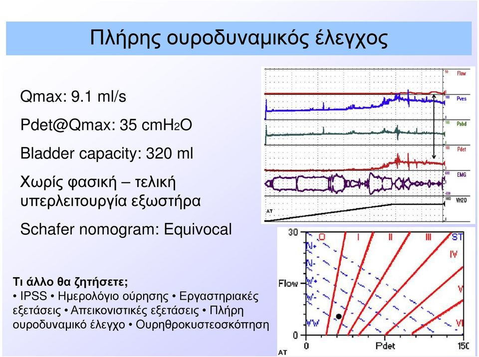 υπερλειτουργία εξωστήρα Schafer nomogram: Equivocal Τι άλλο θα ζητήσετε;