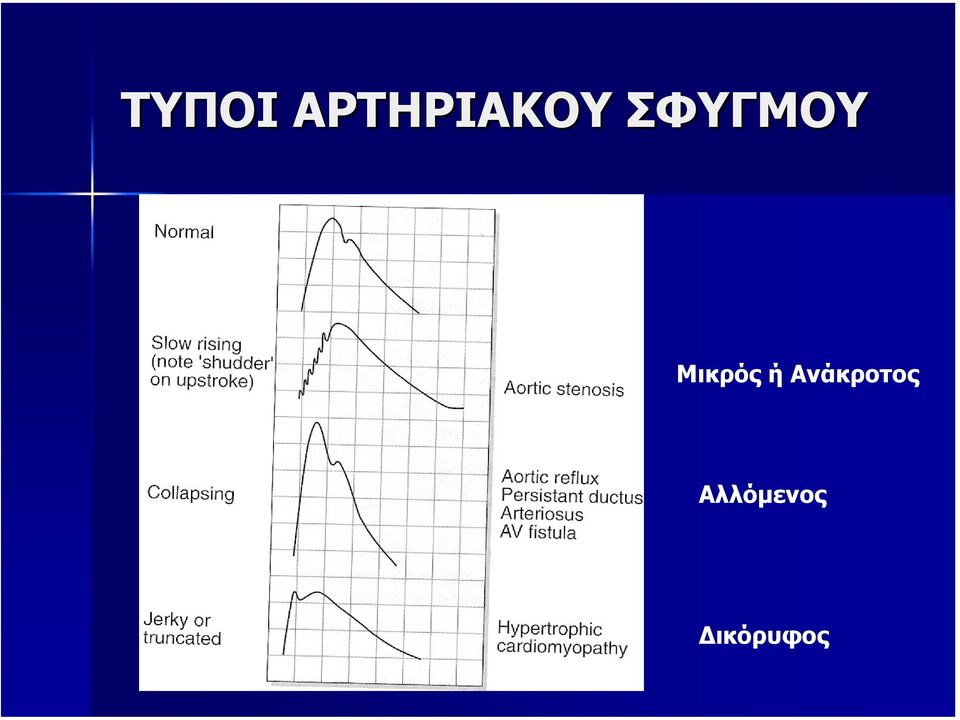 ΣΦΥΓΜΟΥ Μικρός