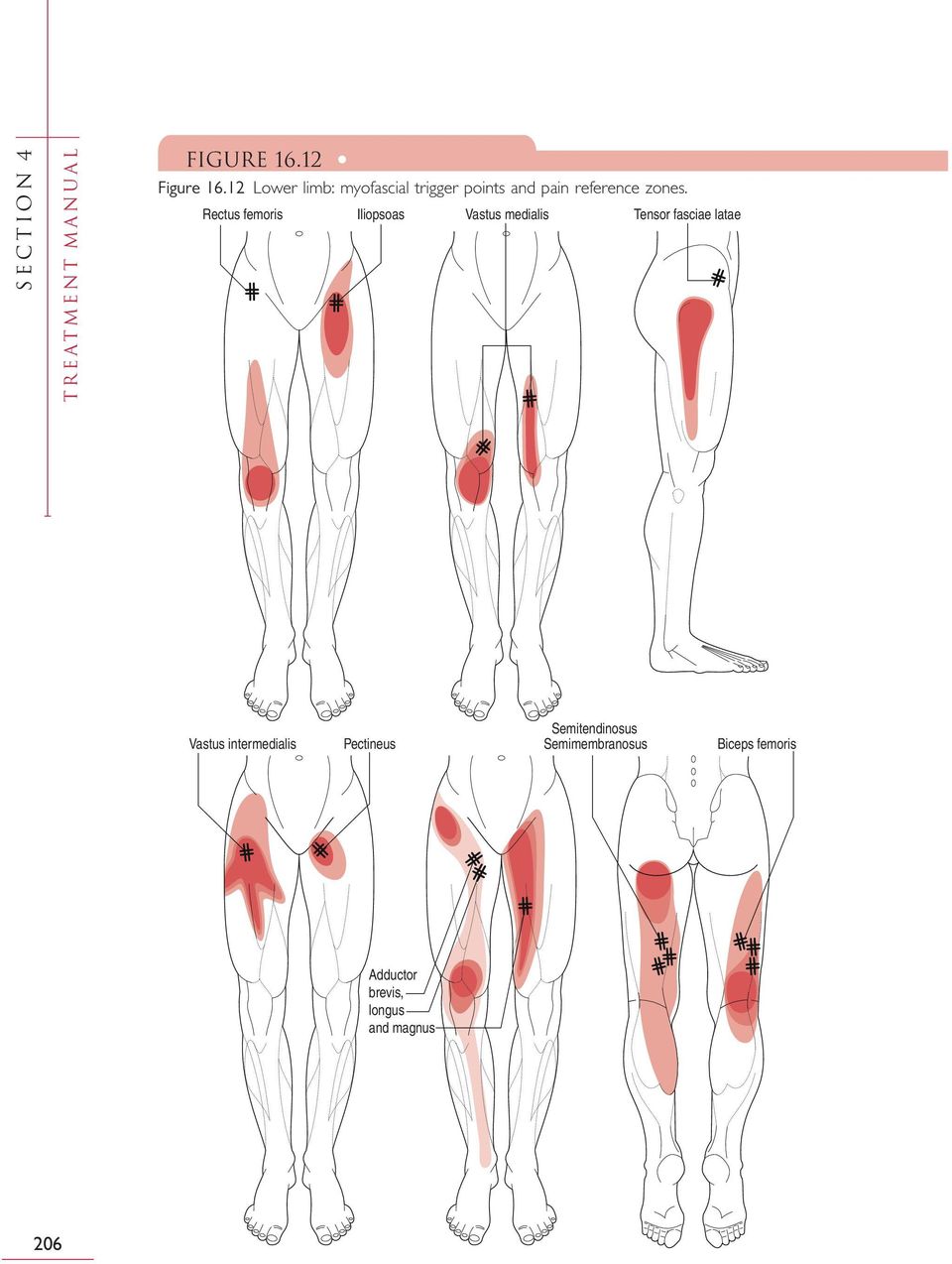 Rectus femoris Iliopsoas Vastus medialis Tensor fasciae latae Vastus