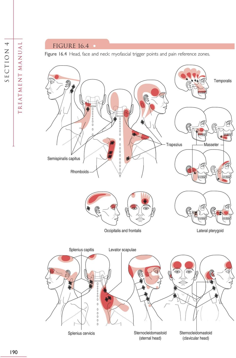 Temporalis Trapezius Masseter Semispinalis capitus Rhomboids Occipitalis and frontalis