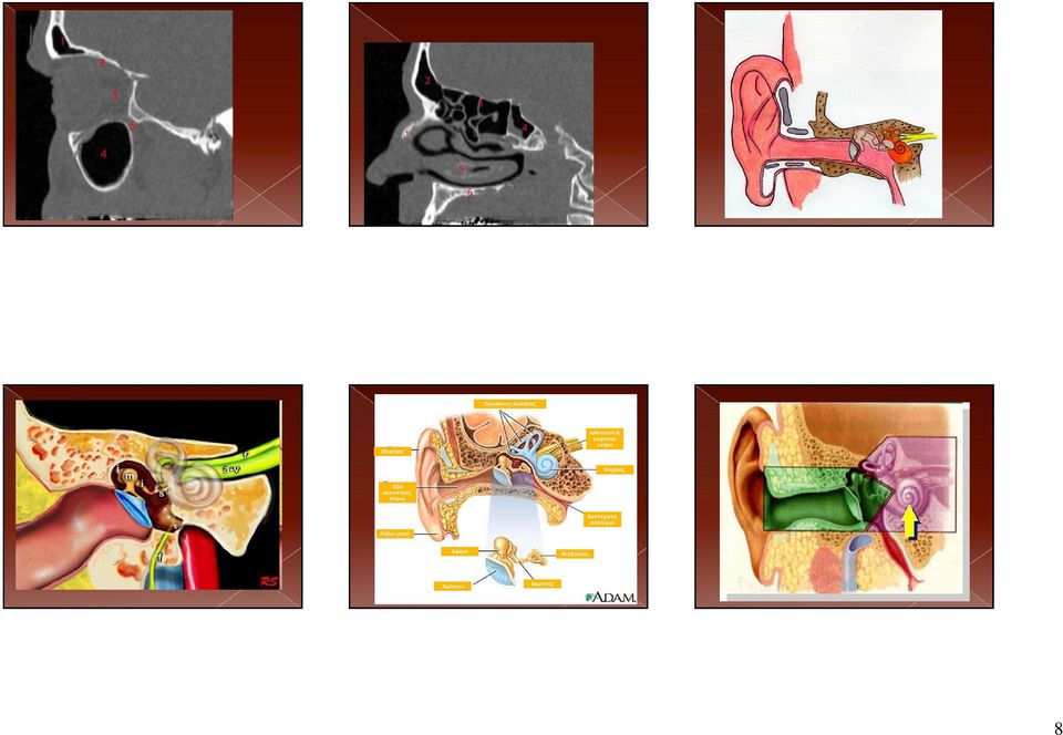 4, Sphenoid sinus. 5, Inferior turbinate. 6, Hard palate.