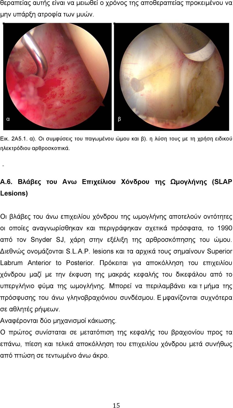 Βλάβες του Ανω Επιχείλιου Χόνδρου της Ωµογλήνης (SLAP Lesions) Οι βλάβες του άνω επιχειλίου χόνδρου της ωµογλήνης αποτελούν οντότητες οι οποίες αναγνωρίσθηκαν και περιγράφηκαν σχετικά πρόσφατα, το