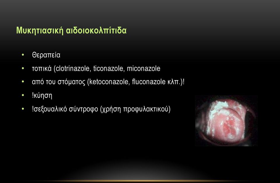 του στόµατος (ketoconazole, fluconazole κλπ.