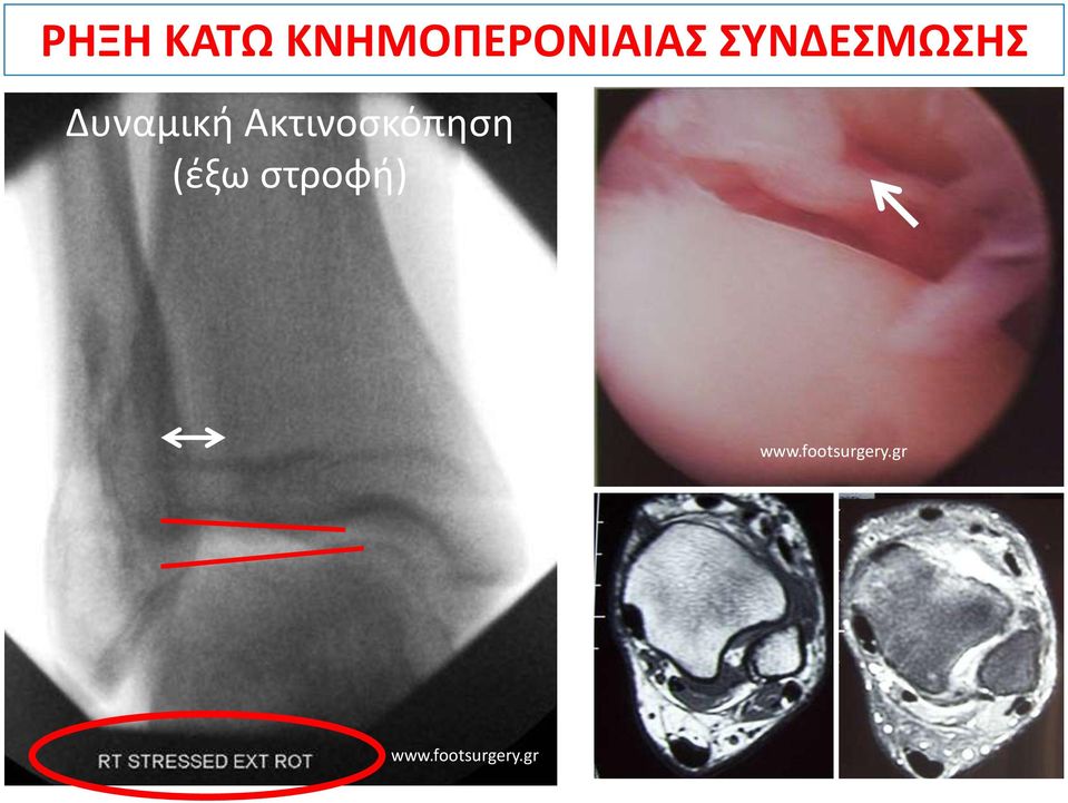 ΣΥΝΔΕΣΜΩΣΗΣ
