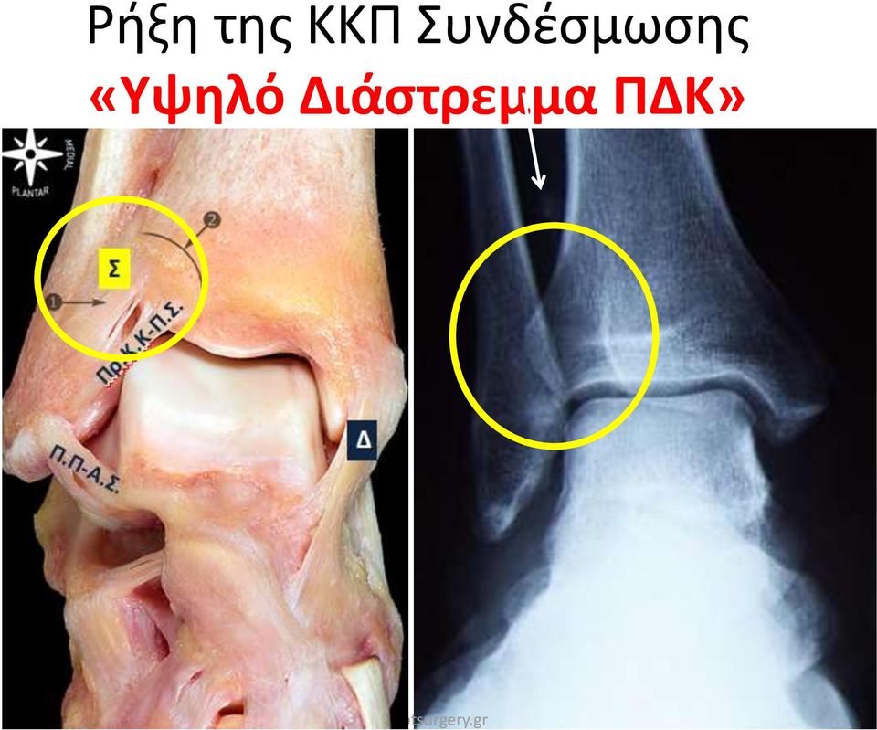 Συνδέσμωσης