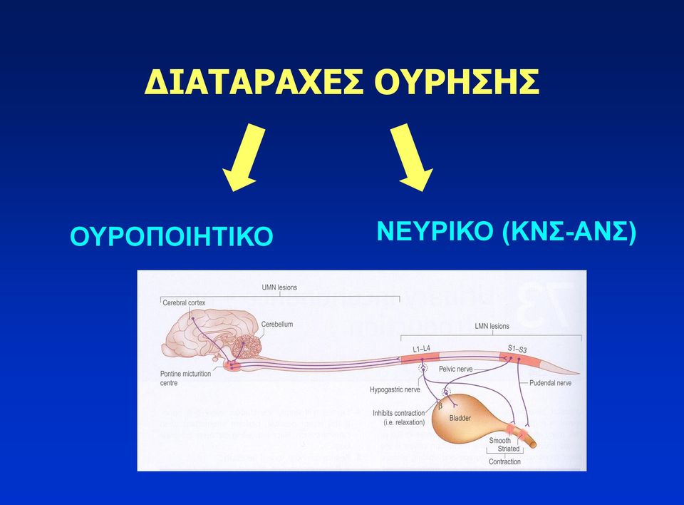 ΟΥΡΟΠΟΙΗΤΙΚΟ