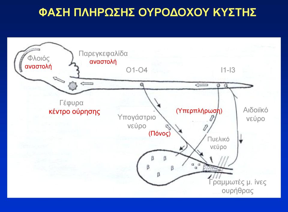 ούρησης Υπογάστριο νεύρο (Πόνος) (Υπερπλήρωση)