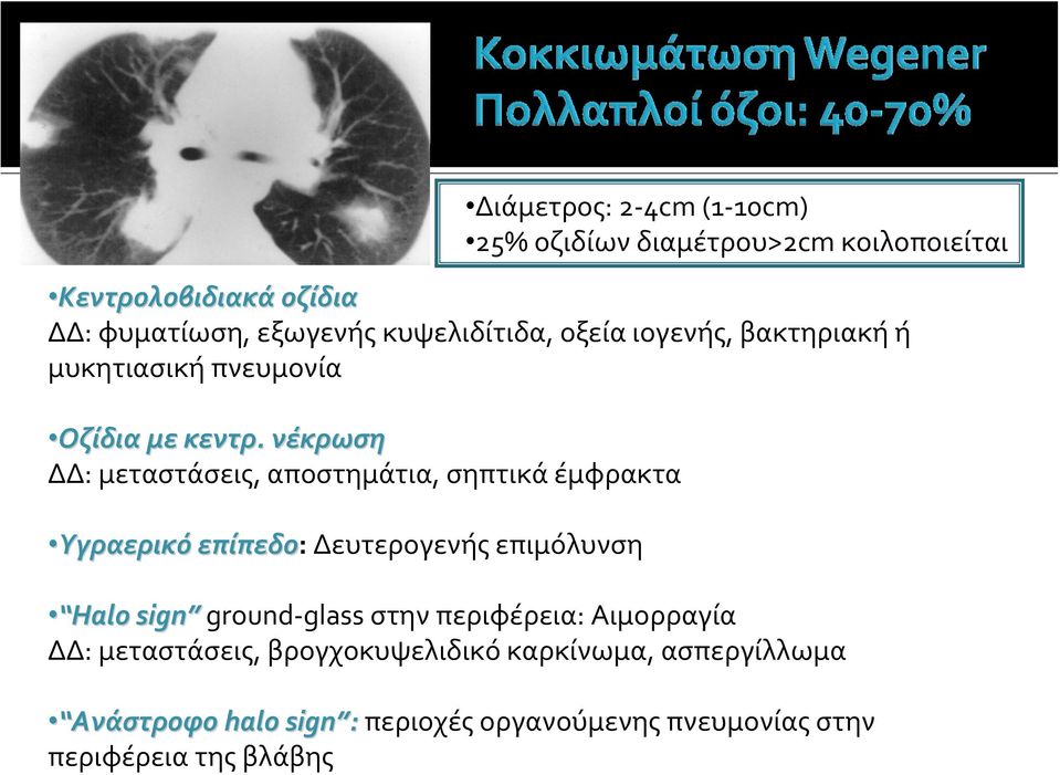 νέκρωση ΔΔ: μεταστάσεις, αποστημάτια, σηπτικά έμφρακτα Υγραερικό επίπεδο: Δευτερογενής επιμόλυνση Διάμετρος: 2 4cm (1