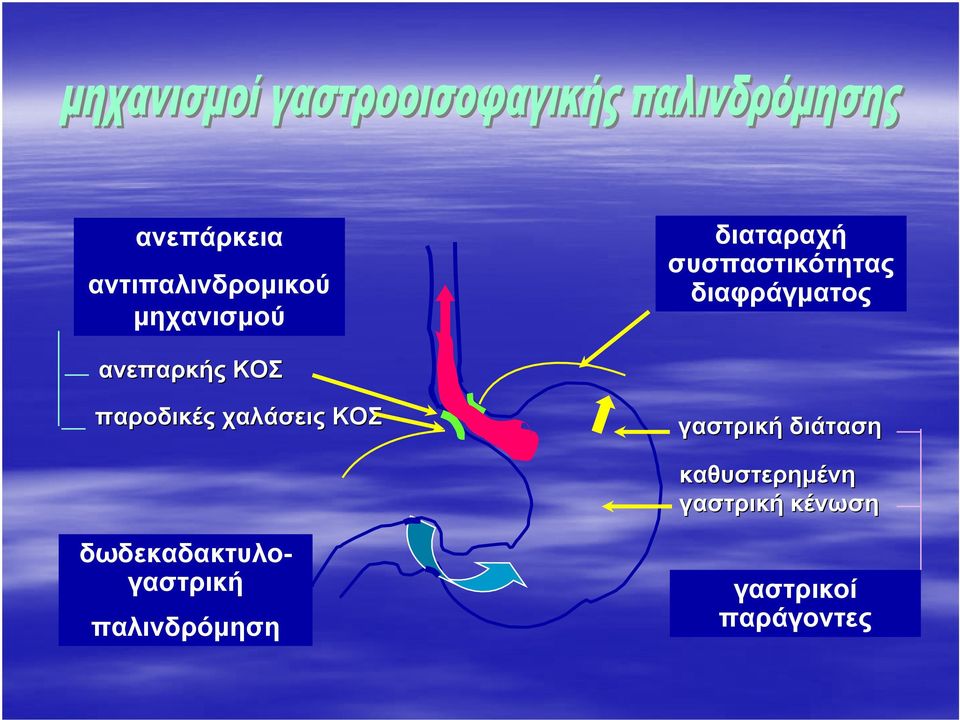 χαλάσεις ΚΟΣ γαστρική διάταση καθυστερημένη γαστρική