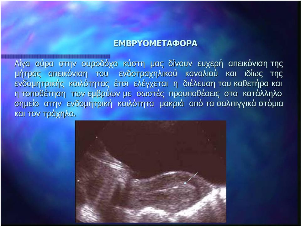 ελέγχεται η διέλευση του καθετήρα και η τοποθέτηση των εμβρύων με σωστές προυποθέσεις