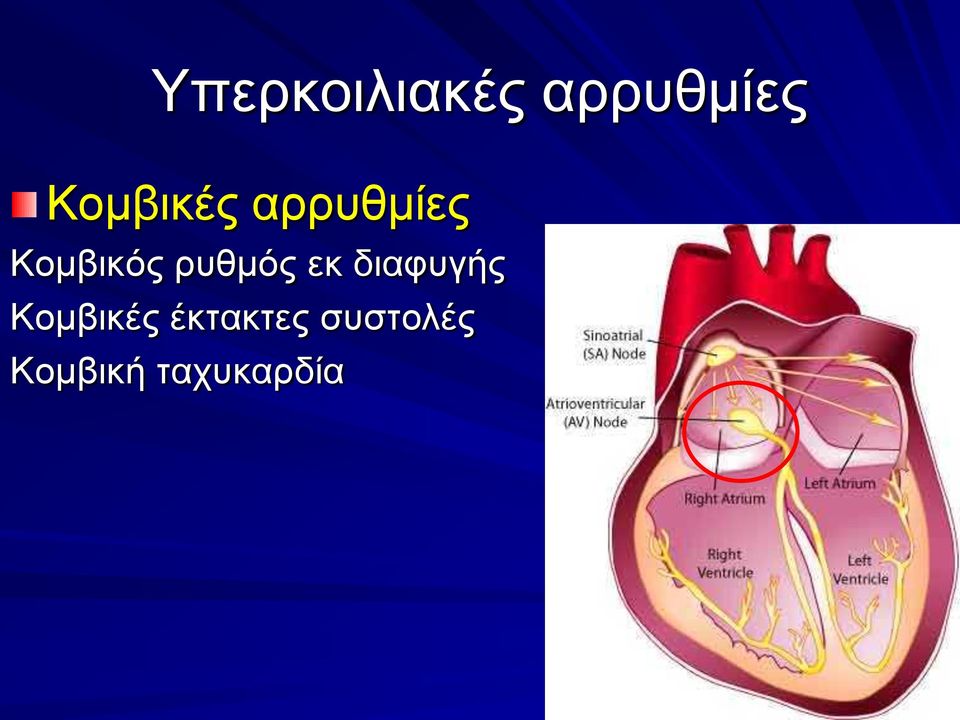 ρυθμός εκ διαφυγής Κομβικές