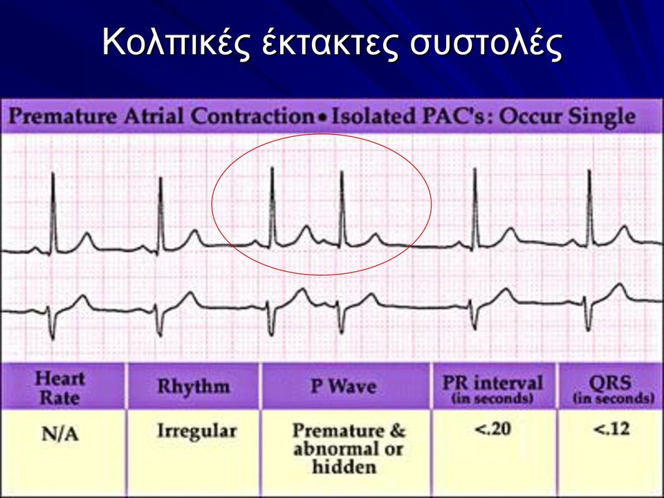 συστολές