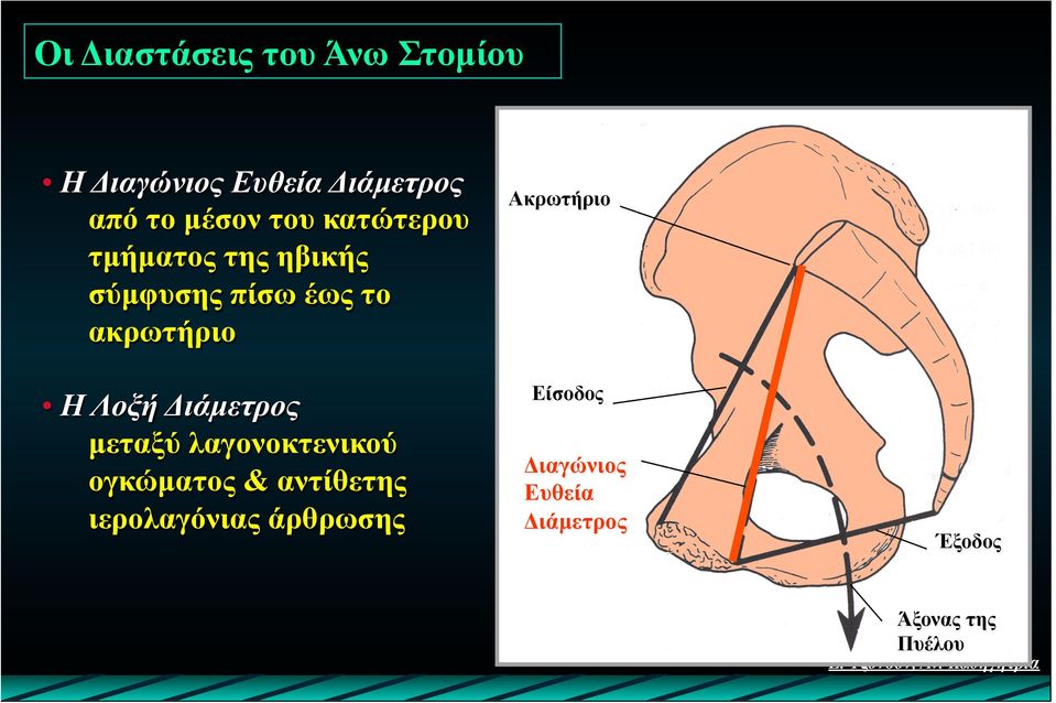 Διάµετρος µεταξύ λαγονοκτενικού ογκώµατος & αντίθετης ιερολαγόνιας