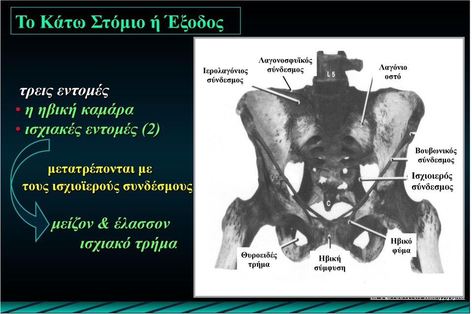 Βουβωνικός σύνδεσµος µετατρέπονται µε τους ισχιοϊερούς συνδέσµους µείζον