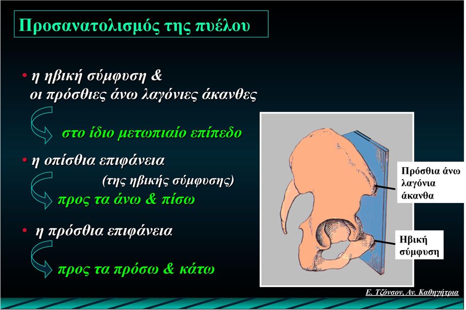 επιφάνεια (της ηβικής σύµφυσης) προς τα άνω & πίσω η πρόσθια